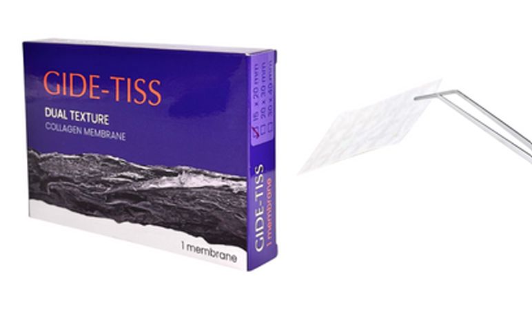 GIDE-TISS